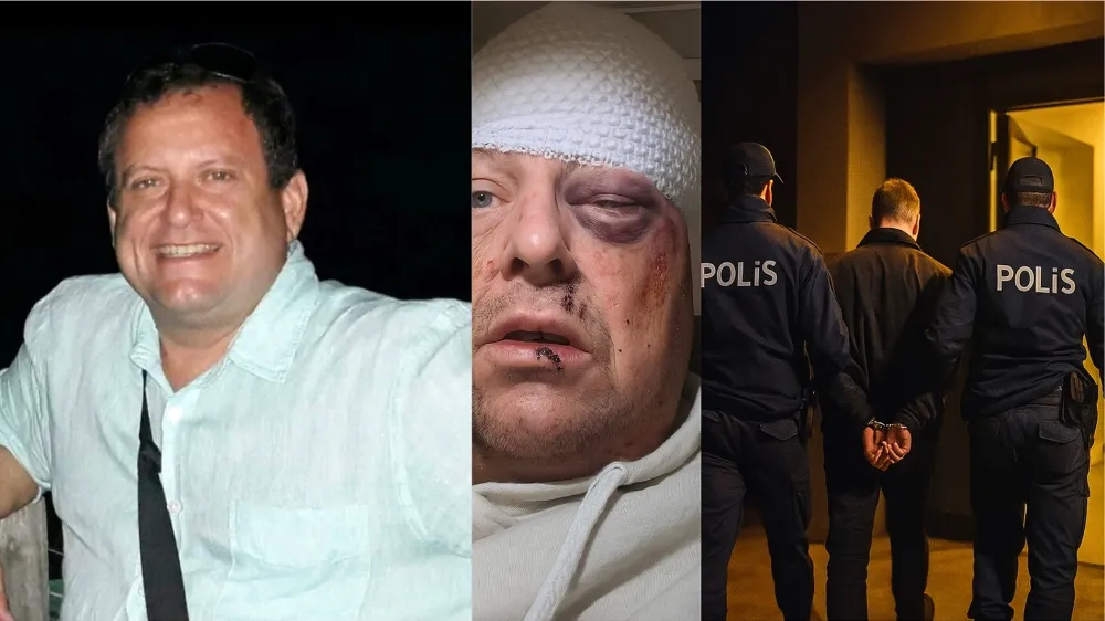 Gazeteciye Saldırıda Bir Tutuklama Daha