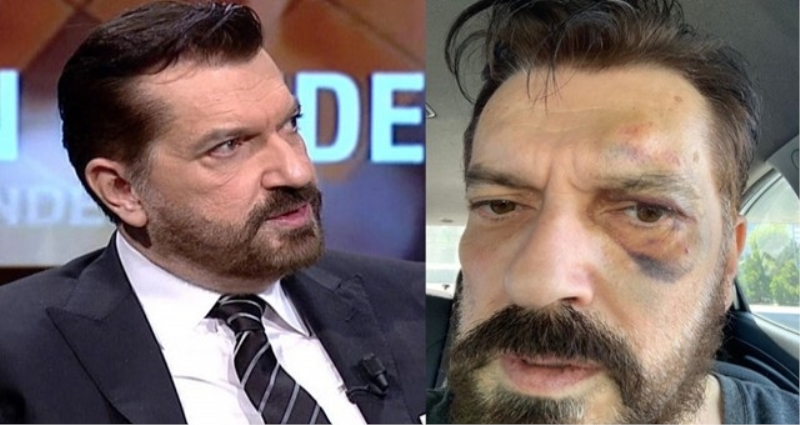 Hakan Bayrakçı’ya saldırı
